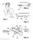 Fig. 02 - Catheter anchor system and method