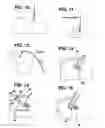 Fig. 04 - Catheter anchor system and method