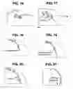 Fig. 05 - Catheter anchor system and method
