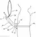Fig. 01 - G-tube retainer