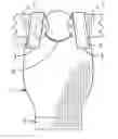 Fig. 01 - Ostomy comfort pad