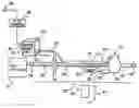 Fig. 01 - Method and apparatus for delivering an agent to the abdomen