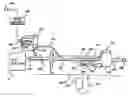 Fig. 01 - Method and apparatus for delivering an agent to the abdomen