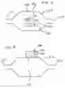Fig. 09 - Method and apparatus for delivering an agent to the abdomen