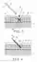 Fig. 03 - Method for inserting solid object into skin