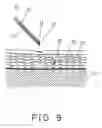 Fig. 06 - Method for inserting solid object into skin
