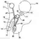 Fig. 01 - Device for draining urine from the human bladder