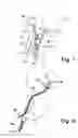 Fig. 02 - Device for draining urine from the human bladder