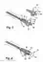 Fig. 04 - Device for draining urine from the human bladder