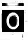 Fig. 09 - Method and apparatus for controlling ablation in refractive surgery