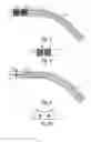 Fig. 04 - Electrosurgical electrode for treating tissue