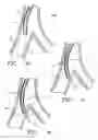 Fig. 17 - Devices for applying energy to tissue