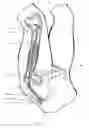 Fig. 05 - Bliskunov device for elongating long bones