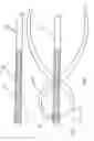 Fig. 03 - Intramedullary pin