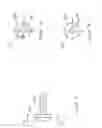 Fig. 18 - Surgical intramedullary implant with improved locking for fixation of fractured bone segments