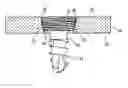 Fig. 01 - Bone plates and methods for provisional fixation using same