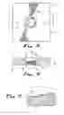 Fig. 07 - Bone plates and methods for provisional fixation using same