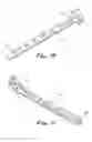Fig. 09 - Bone plates and methods for provisional fixation using same
