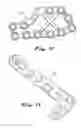 Fig. 10 - Bone plates and methods for provisional fixation using same