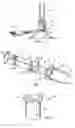 Fig. 02 - Method and device for umbilicus protection during abdominal surgery