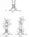 Fig. 04 - Method and device for umbilicus protection during abdominal surgery