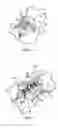 Fig. 06 - Method and device for umbilicus protection during abdominal surgery