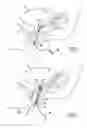 Fig. 04 - Mini sub-urethral-cervical support