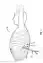 Fig. 02 - Devices and methods for heart valve repair