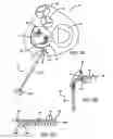 Fig. 03 - Devices and methods for heart valve repair