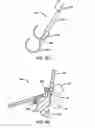 Fig. 05 - Devices and methods for heart valve repair