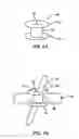 Fig. 07 - Devices and methods for heart valve repair