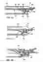 Fig. 19 - Devices and methods for heart valve repair