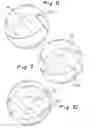 Fig. 07 - Bladeless obturator