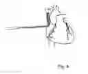 Fig. 03 - Dynamic cannula
