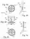 Fig. 05 - Vaginal delineation and occlusion device
