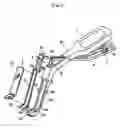 Fig. 02 - Surgical method for mandibular angle fracture operation and devices therefor