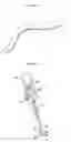 Fig. 08 - Surgical method for mandibular angle fracture operation and devices therefor