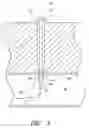Fig. 04 - Vascular wound closure device and method