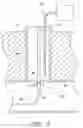 Fig. 05 - Vascular wound closure device and method