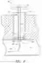 Fig. 06 - Vascular wound closure device and method