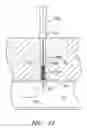Fig. 46 - Vascular wound closure device and method