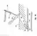Fig. 07 - Method and apparatus for sealing an internal tissue puncture incorporating a block and tackle