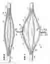 Fig. 07 - Methods for treating the cardia of the stomach
