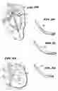 Fig. 17 - Methods for treating the cardia of the stomach