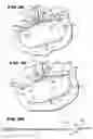Fig. 19 - Methods for treating the cardia of the stomach