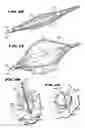 Fig. 24 - Methods for treating the cardia of the stomach