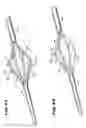 Fig. 27 - Methods for treating the cardia of the stomach