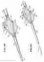 Fig. 30 - Methods for treating the cardia of the stomach