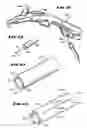 Fig. 31 - Methods for treating the cardia of the stomach