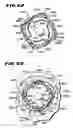 Fig. 33 - Methods for treating the cardia of the stomach